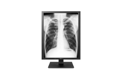 Монитор 21.3 LG 21HK512D-B IPS 1000CD